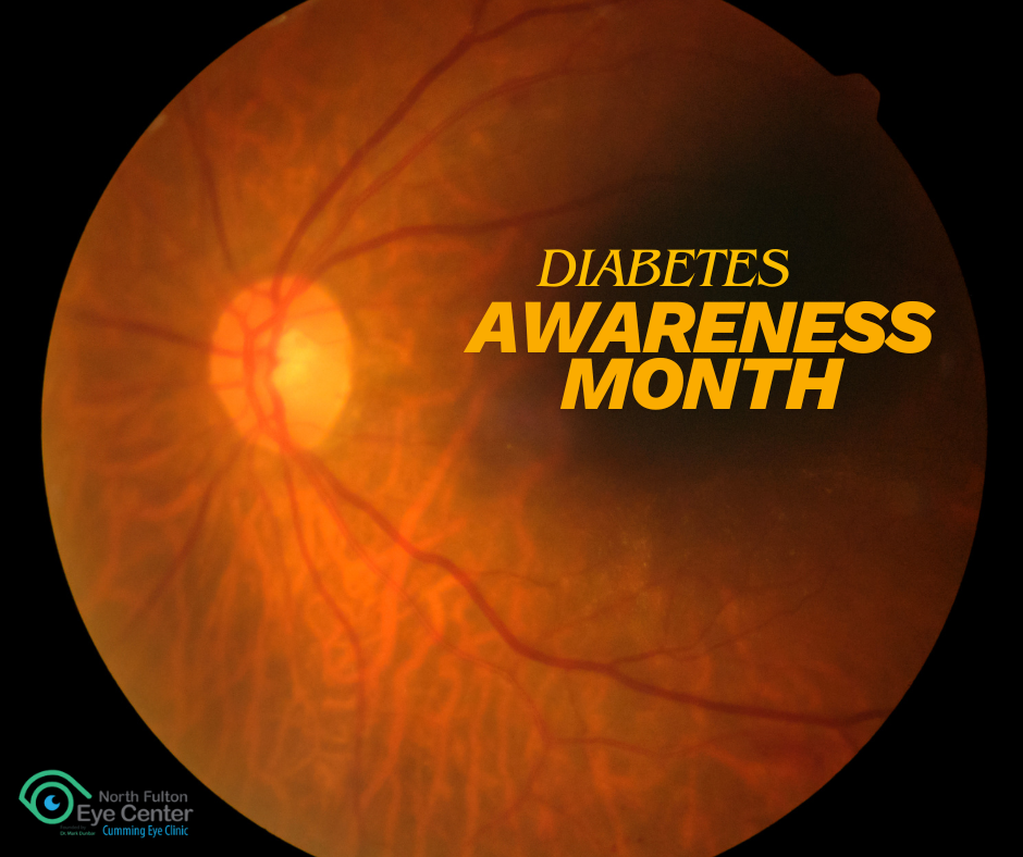 American Diabetes Month: Protecting Vision and Preventing Diabetic Eye Disease in North Fulton and Cumming, Georgia