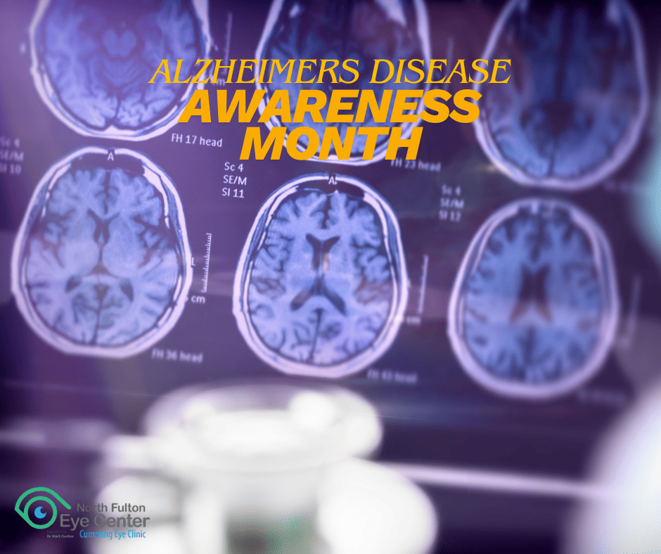 Alzheimer’s Disease Awareness Month: Understanding the Connection Between Cognitive Health and Vision in North Fulton and Cumming
