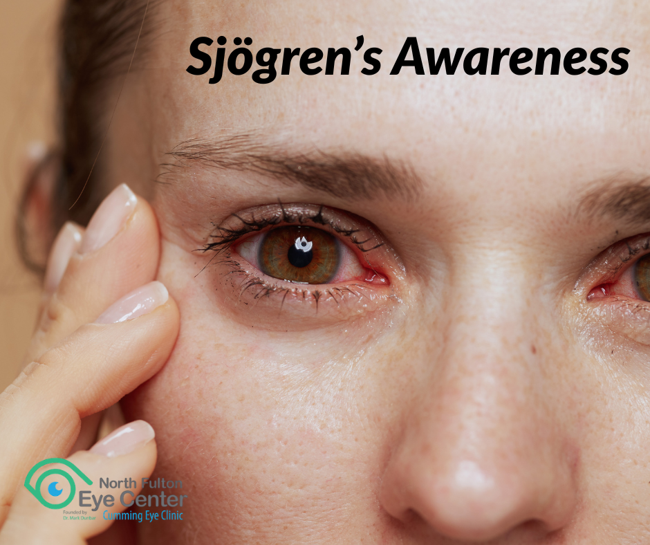 World Sjögren’s Day: When Dry Eyes May Be More Than Dry Eyes